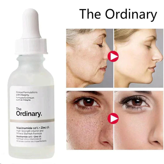 The Ordinary Niacinamide 10% + Zinc 1% – 30ml (100%) Orignal (2 days Delivery)